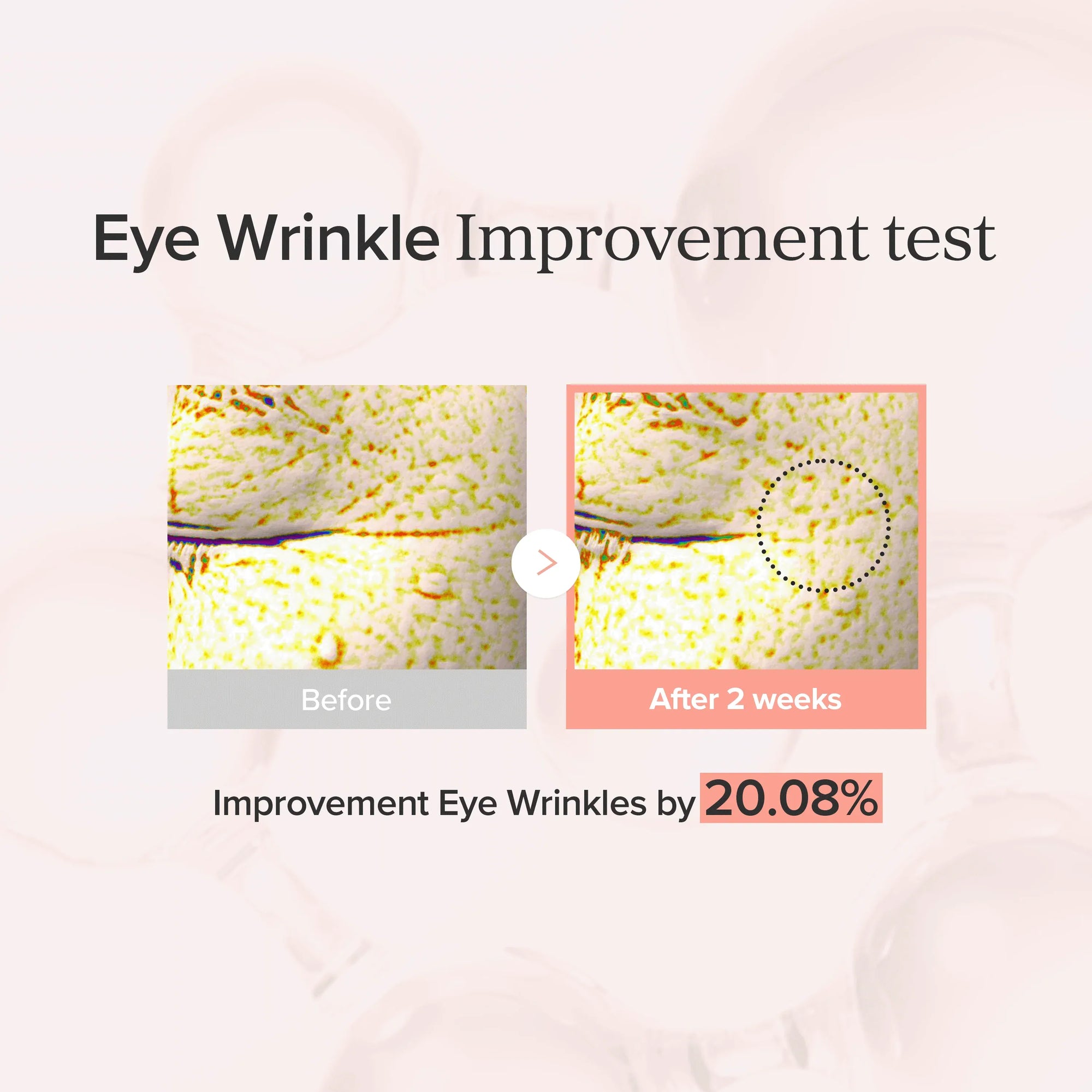 Tap under eye
